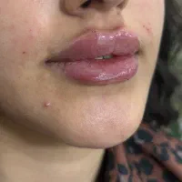 خدمات زیبایی