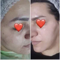 فیشیال و پاک سازی درمانی ۵۰۰ تومان گلستان،سعدی|خدمات آرایشگری و زیبایی|اهواز, کوی سعدی|دیوار