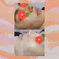 فیشال تخصصی (فرصت استثنایی)|خدمات آرایشگری و زیبایی|مشهد, تلگرد|دیوار