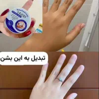 محصولات سفیدکننده و گلوتاتیون صورت و بدن تضمینی