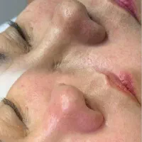 پاکسازی تخصصی  پوست|خدمات آرایشگری و زیبایی|دهدشت, |دیوار