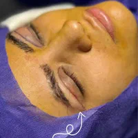 ساکشن سوپر کانتور صورت بلفارو بوکال تزریق چربی|خدمات آرایشگری و زیبایی|مشهد, ملک‌آباد|دیوار