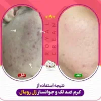 ژل کرم رویال|آرایشی، بهداشتی، درمانی|نورآباد ممسنی, |دیوار