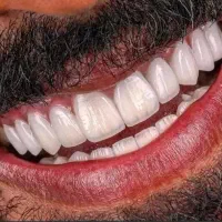 خدمات دندانپزشکی/ایمپلنت/کامپوزیت/لمینت