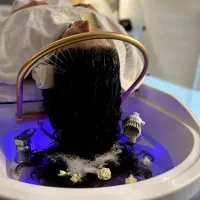 لیزر و فیشال و اسکراب اسکالپ