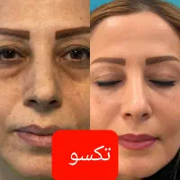 بامحصولات تکسو مثل الماس بدرخشید|آرایشی، بهداشتی، درمانی|سمنان, |دیوار