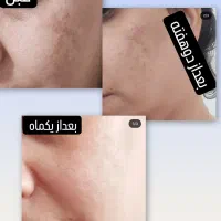 فشیال تخصصی آقایان و بانوان درکلینیک زیبایی کوروش|خدمات آرایشگری و زیبایی|فردیس, قریشی|دیوار