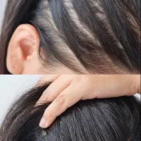 کم‌پشتی مو رو پنهان نکن برطرفش کن