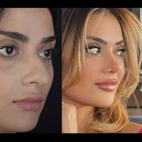 جراحی بینی پیکرتراشی برزیلی لیپو پروتز لیفت سینه|خدمات آرایشگری و زیبایی|تهران, تهرانپارس غربی|دیوار
