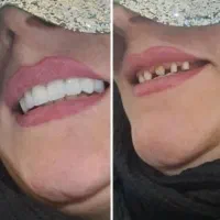 خدمات دندان پزشکی|خدمات آرایشگری و زیبایی|بروجرد, |دیوار