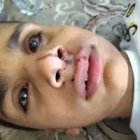 به بچه نابینا تور خدا کمک کنید