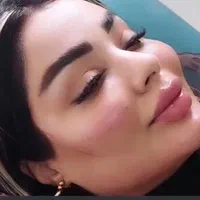 مزو،بوتاکس،چربی،فیلر،جراحی زیبایی صورت وبدن|خدمات آرایشگری و زیبایی|تهران, نارمک|دیوار