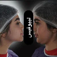 اندولیفت.لیپوفیس.ساکشن غبغب با اولترا زد|خدمات آرایشگری و زیبایی|مشهد, سناباد|دیوار
