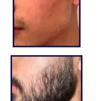 موهاتو مثل جنگل آمازون کن|آرایشی، بهداشتی، درمانی|تهران, آذری|دیوار