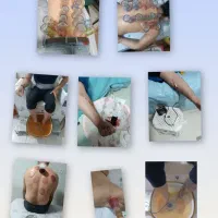 حجامت و بادکش درمانی (تحت نظر پزشک)|خدمات آرایشگری و زیبایی|خرم‌آباد, |دیوار