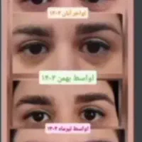 اکسیرپرپشتی مو ،مژه و ابرو