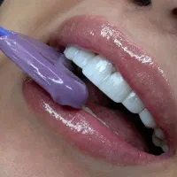 دندانپزشکی کامپوزیت فکی ۸ میلیون با ضمانت ده ساله|آرایشی، بهداشتی، درمانی|رشت, بازار|دیوار