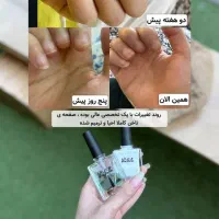 سرم دو فاز ناخن