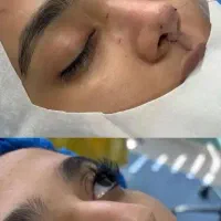 عمل بینی در بیمارستان ۴۵ تومن و کلینیک ۳۰ تومن|خدمات زیبایی و سلامت|اهواز, کیانپارس |دیوار