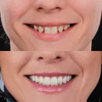 دندانپزشکی تخصصی و تضمینی|خدمات آرایشگری و زیبایی|کرمانشاه, |دیوار