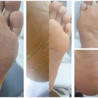 کف سابی پا به همراه ژلیش