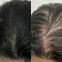 موهاتو از ریشه تقویت کن