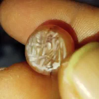 مهره قدیمی