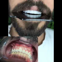 دندانپزشکی|خدمات آرایشگری و زیبایی|بروجرد, |دیوار