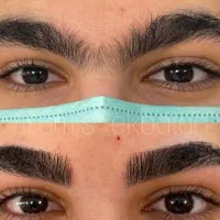 اصلاح صورت و ابروی تخصصی و بافت