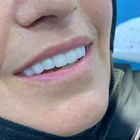 دندانپزشکی مرکز تخصصی ایمپلنت دکتر حقیقت|خدمات آرایشگری و زیبایی|شیراز, ستارخان|دیوار