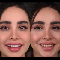 دندانپزشکی عصب کشی/ ترمیم / کشیدن/ جراحی عقل/