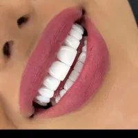 تخفیف کامپوزیت لمینت با اقساط|خدمات آرایشگری و زیبایی|قم, مهدیه|دیوار