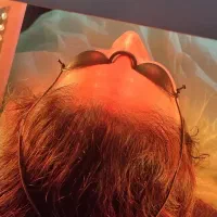 فیشال پوست با بهترین قیمت هدیه ماه پراز تخفیف