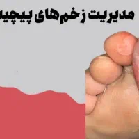 درمانگر زخم