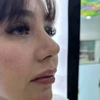 تخفیفات مرکز پوست و مو ولیزر آیشیل
