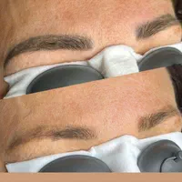 لیزر ریموو تتو در مطب پزشک و توسط پزشک|خدمات آرایشگری و زیبایی|تهران, سلسبیل شمالی|دیوار
