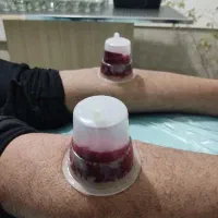 حجامت، زالودرمانی،بادکش درمانی در پرند|خدمات آرایشگری و زیبایی|پرند, فاز ۵|دیوار