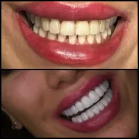 جشنواره کامپوزیت با طراحی لبخند/شیشه ای.