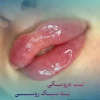 آف ویژه خدمات فیلر ژل و بوتاکس مزو تراپی