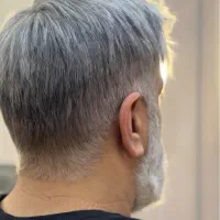 پروتز مو ، جایگزینِ کاشت مو (وارداتی - VIP)|خدمات آرایشگری و زیبایی|تهران, تهرانسر شمالی|دیوار