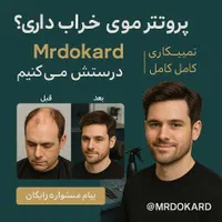 ترمیم و تعمیر پروتز مو