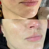 محصولات مراقبتی لاکچری کوین اصل