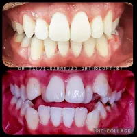 ارتودنسی مشهدتمام اقساط بابهترین متخصص ارتدنس مشهد