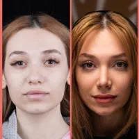 عمل بینی/با39میلیون قیمت سال قبل+اقساط