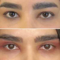 جراحی بینی و پلک و لیپوساکشن و فیلر بادی