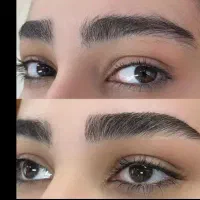 اصلاح صورت وکوتاهی