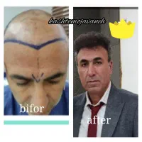 جشنواره یلدایی کاشت موشیرازی از۱۳تومن