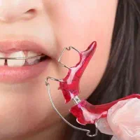 ارتودنسی به نرخ دولتی برای کودکان ۸ تا ۱۲ سال