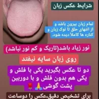 مشاوره ودرمان با محصولات گیاهی