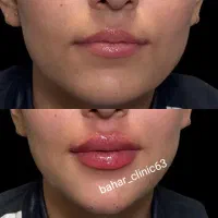 کلینیک تخصصی زیبایی|خدمات آرایشگری و زیبایی|اهواز, کیانپارس |دیوار